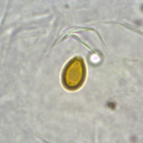 Basidiospore